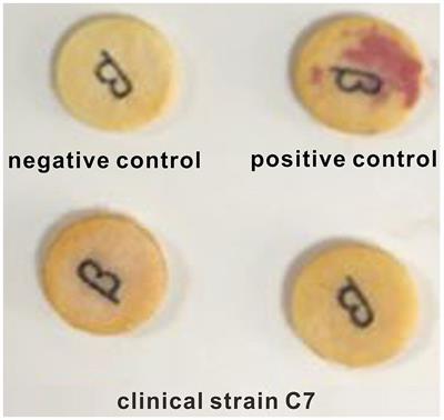 Matrine reverses the resistance of Haemophilus parasuis to cefaclor by inhibiting the mutations in penicillin-binding protein genes (ftsI and mrcA)